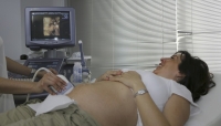 Imagen de una mujer embarazada recibiendo una ecografía.